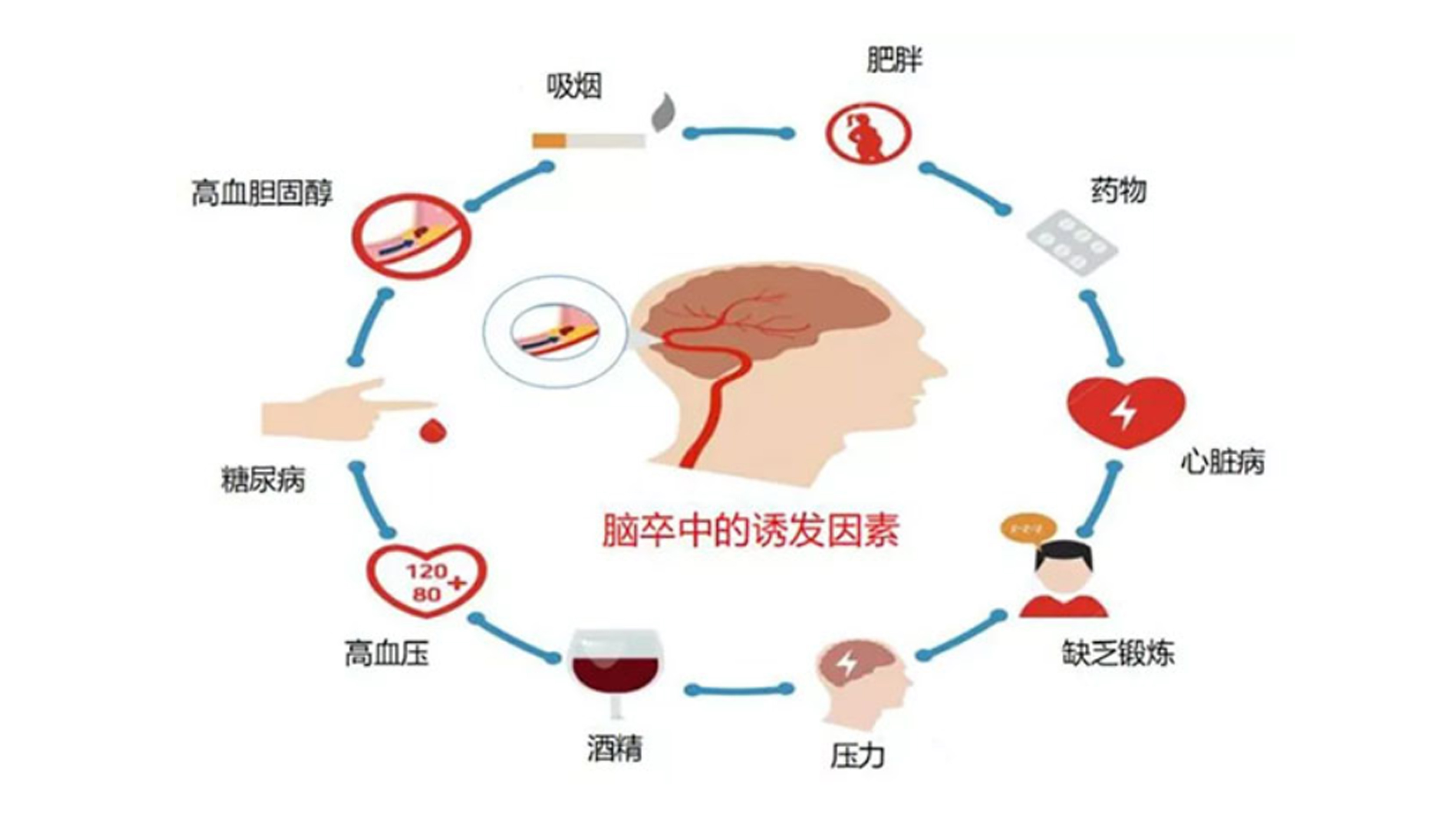 腦梗與深靜脈血栓：不可忽視的血管危機