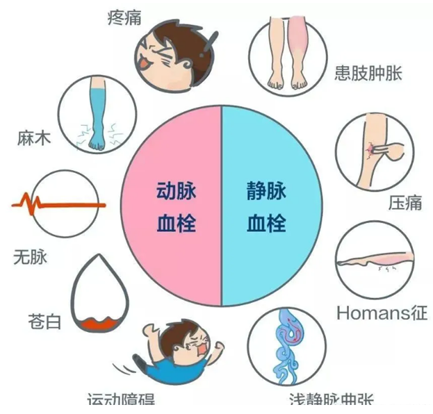 2022世界血栓日：就醫(yī)有新路，血栓找介入