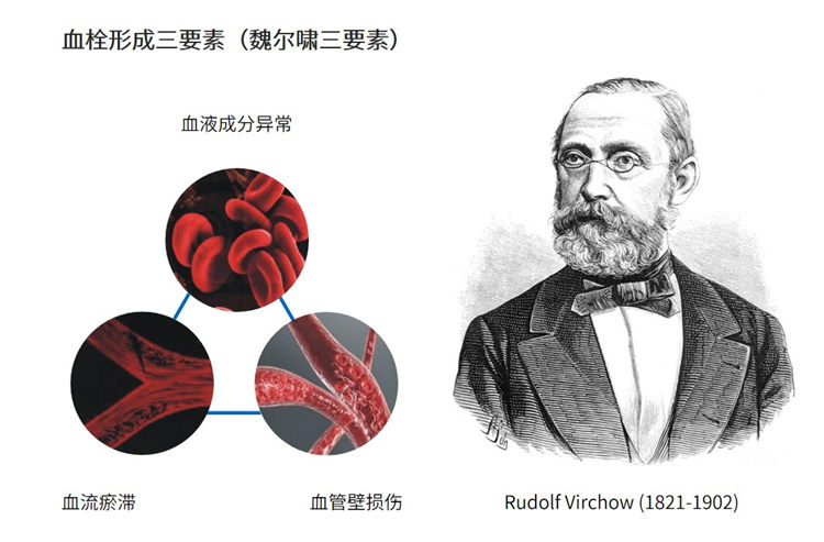 世界血栓日 | 拴不住，動(dòng)起來(lái)