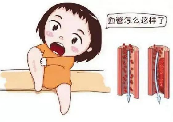 腫瘤不容忽視的第二號殺手—VTE，該如何防治？