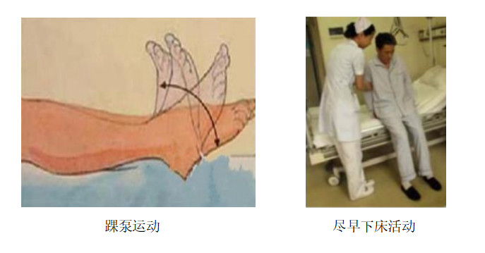 圍術(shù)期患者VTE的預(yù)防，只知道抗凝可不行